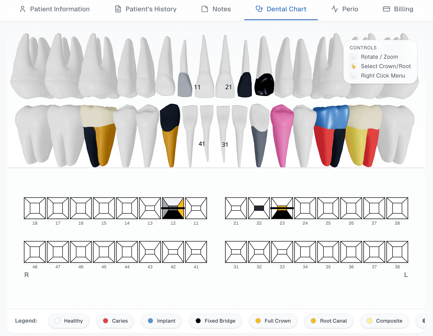 3D Dental Chart Visualization